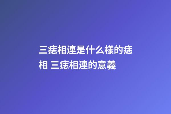 三痣相連是什么樣的痣相 三痣相連的意義